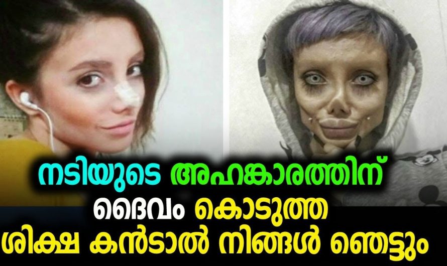 നടിയുടെ അഹങ്കാരത്തിന് ദൈവം കൊടുത്ത ശിക്ഷ കണ്ടോ