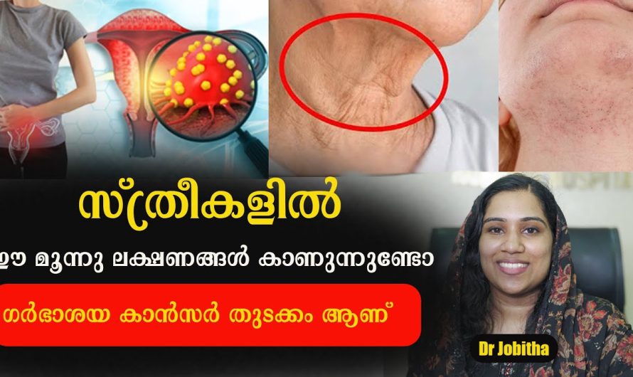 സ്ത്രീകൾ ഈ ലക്ഷണങ്ങൾ അവഗണിച്ചാൽ ഉറപ്പാണ് കാൻസർ