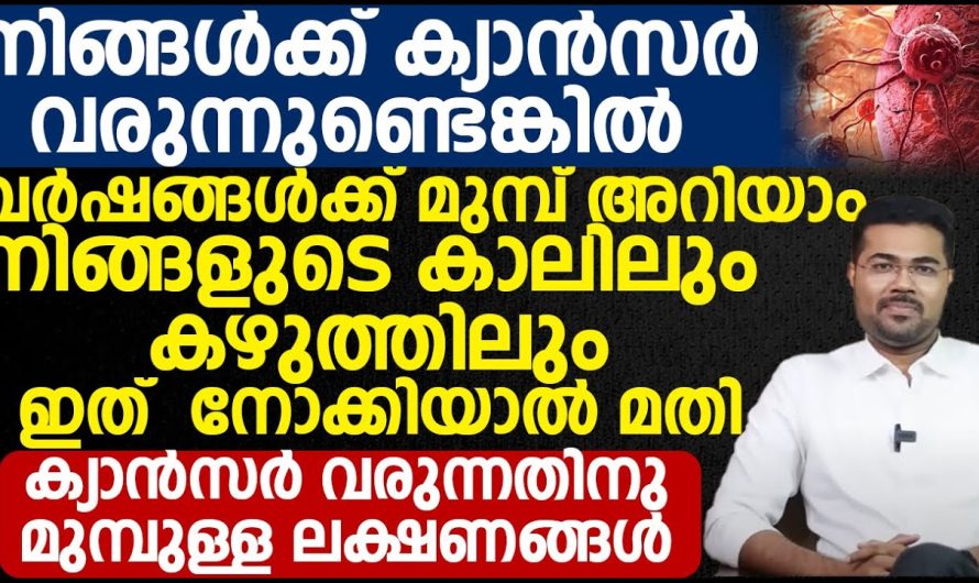 ക്യാൻസർ വരുന്നതിനു മുമ്പുള്ള ലക്ഷണങ്ങൾ?? ശ്രദ്ധിക്കുക