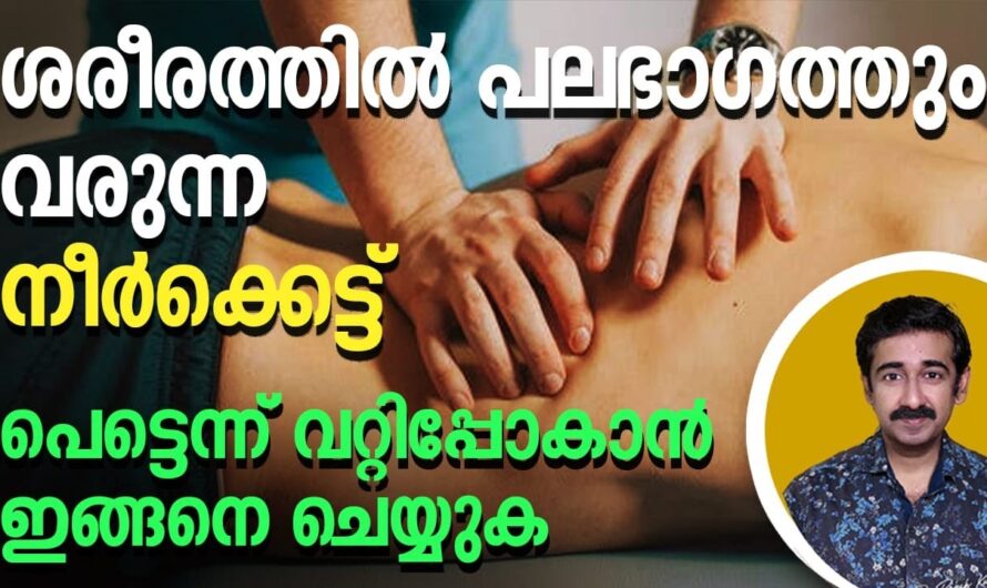 Why does edema occur in the body? You may know these 6 reasons!