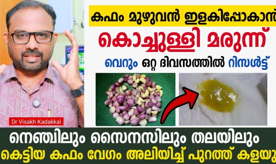 Chronic Cough; 6 Causes You Should Know!