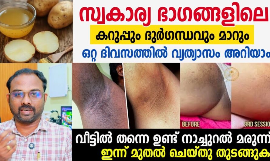 Darkness and odor in private parts; Causes and solutions!