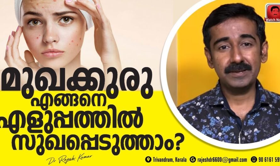 Why do you get acne? 6 reasons you shouldn’t ignore!