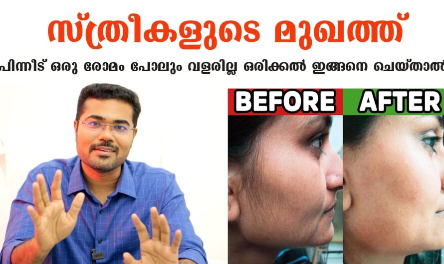 No need for chemicals to remove unwanted facial hair; try these 5 natural ways!