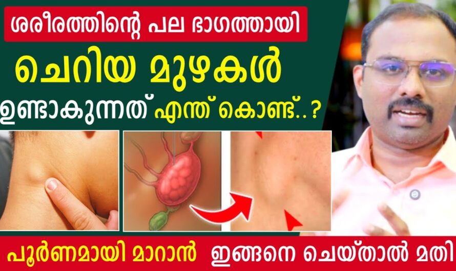 Why do lumps appear on the body? 6 reasons you should know!