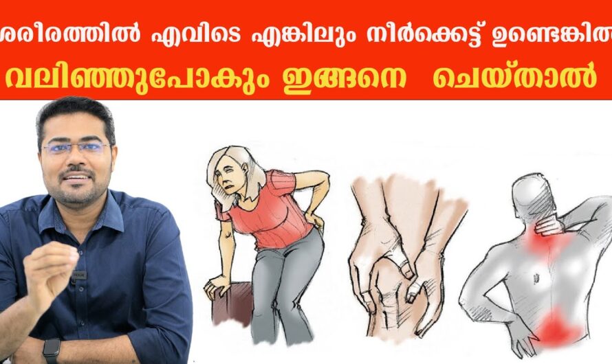 Why does swelling occur in the body? Top 6 reasons!