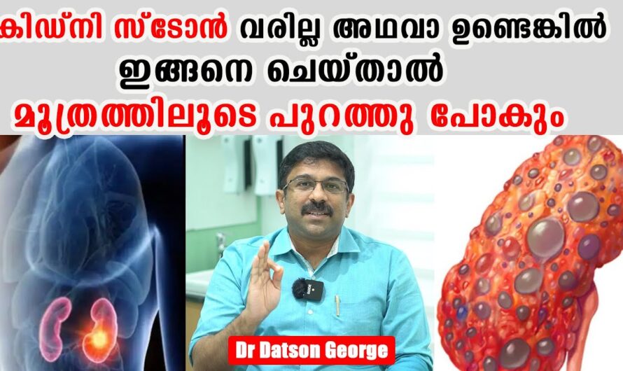 Why do kidney stones form? 6 reasons you should know!