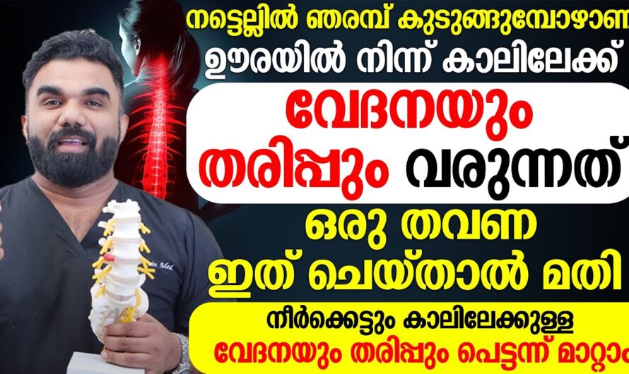 Does back pain spread to the legs? Everything you need to know about ‘sciatica’!