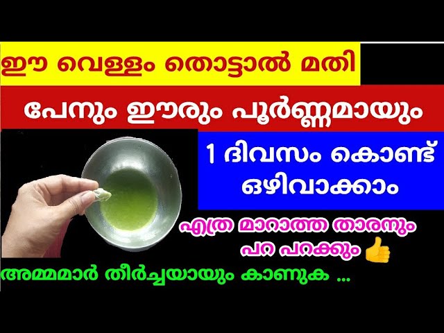 Dandruff won’t go away? These 6 reasons could be the culprit!