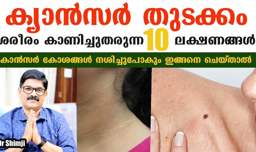 Why does cancer occur? The main causes you should know