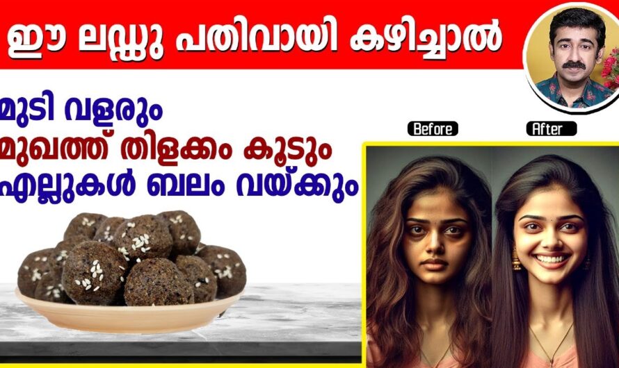 These 5 things are enough to make your hair grow; Hair loss will stop and your hair will grow like a forest!