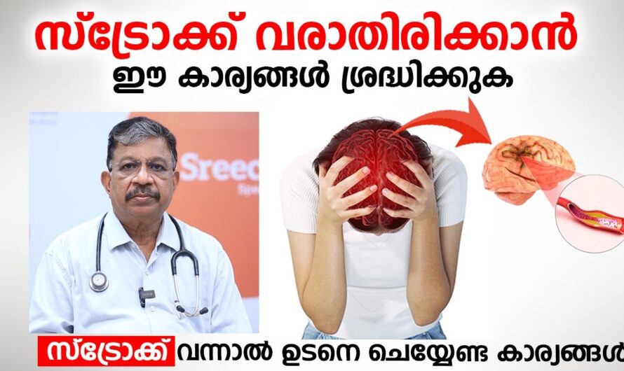 Stroke can be prevented; If you pay attention to these 6 things, you can avoid the risk of brain damage!