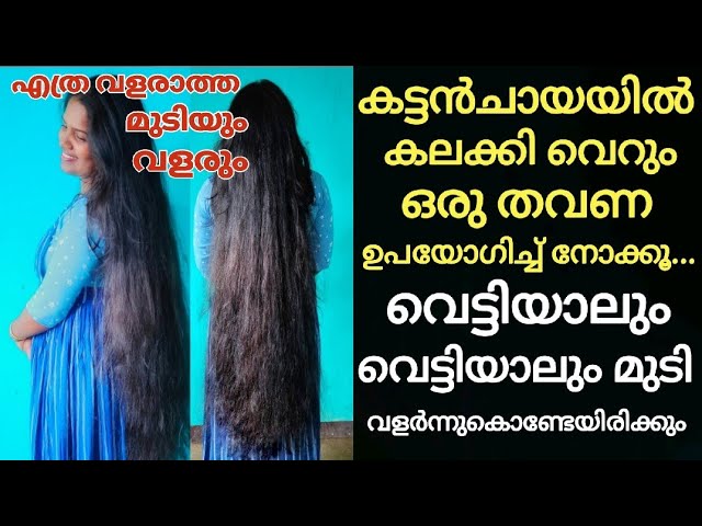 These 5 things are enough to make your hair grow; Stop hair loss and grow like a forest!