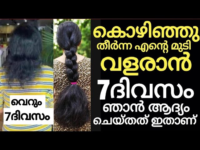 Want to grow hair like a forest? 5 ways to stop hair loss and grow hair!