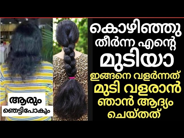 Want to grow hair like a forest? 5 ways to stop hair loss and grow hair lushly!