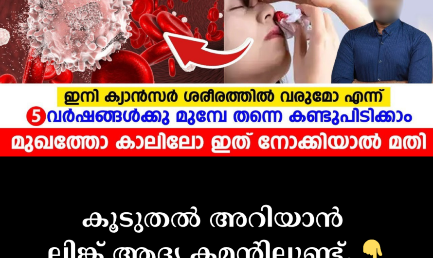 Abnormal changes in blood cells: 5 main things that cause blood cancer