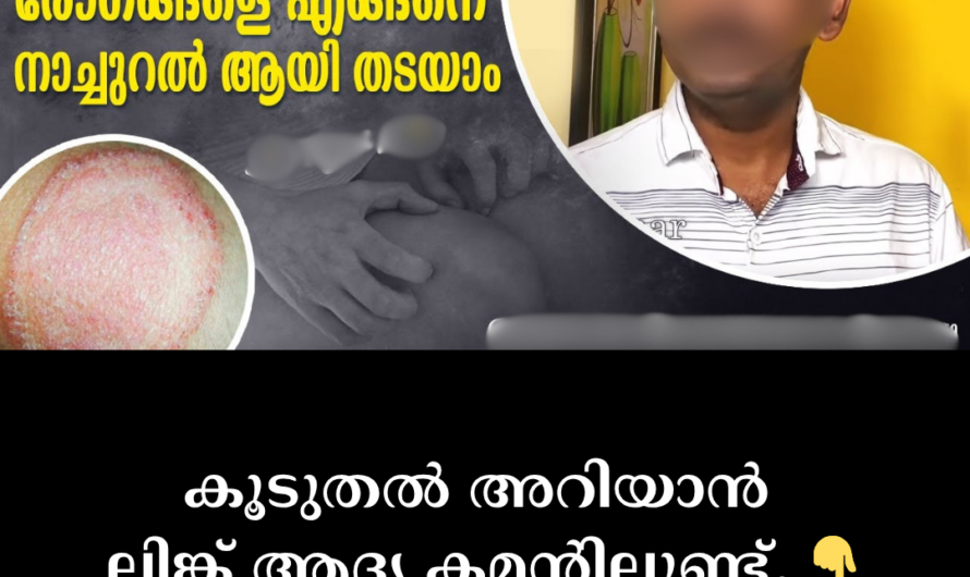 Are you bothered by persistent itching? Know these 5 villains that cause skin discomfort