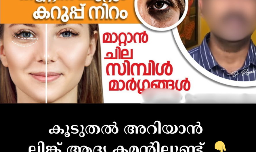 Are dark circles and puffiness around the eyes ruining your beauty? Here are 5 main causes