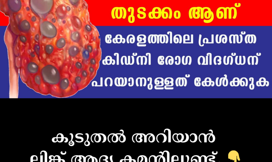 In the same format you requested, the article on the main causes of kidney damage/failure is given below: