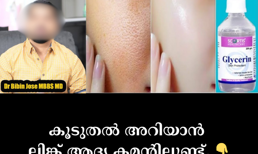 Applying glycerin on your face like this will make incredible changes! Here are 5 reasons why it is beneficial