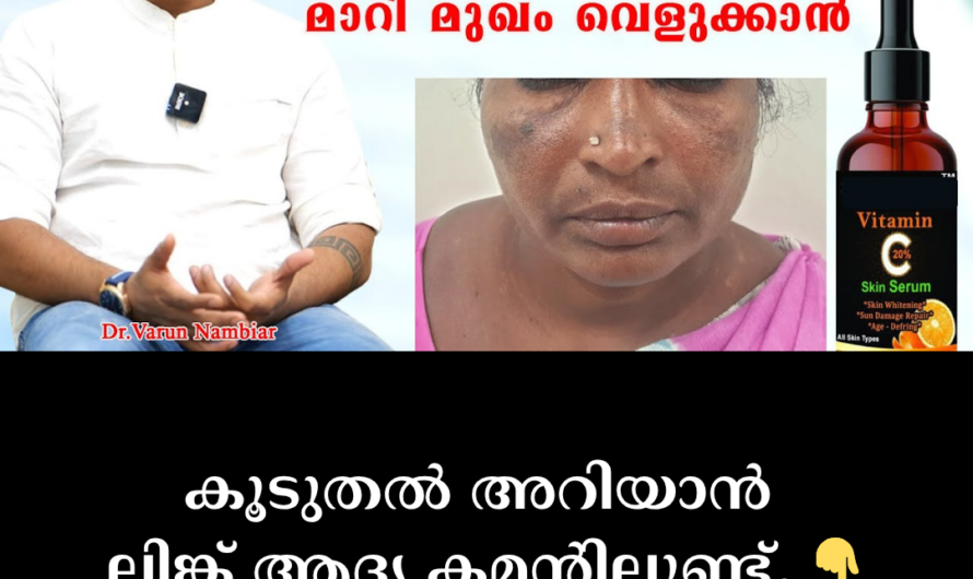 Does dark spots on the face reduce self-confidence? 5 main reasons behind dark spots and skin discoloration