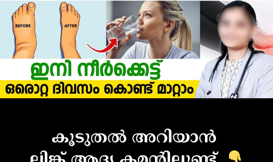 Is your whole body swollen? 5 main causes of edema