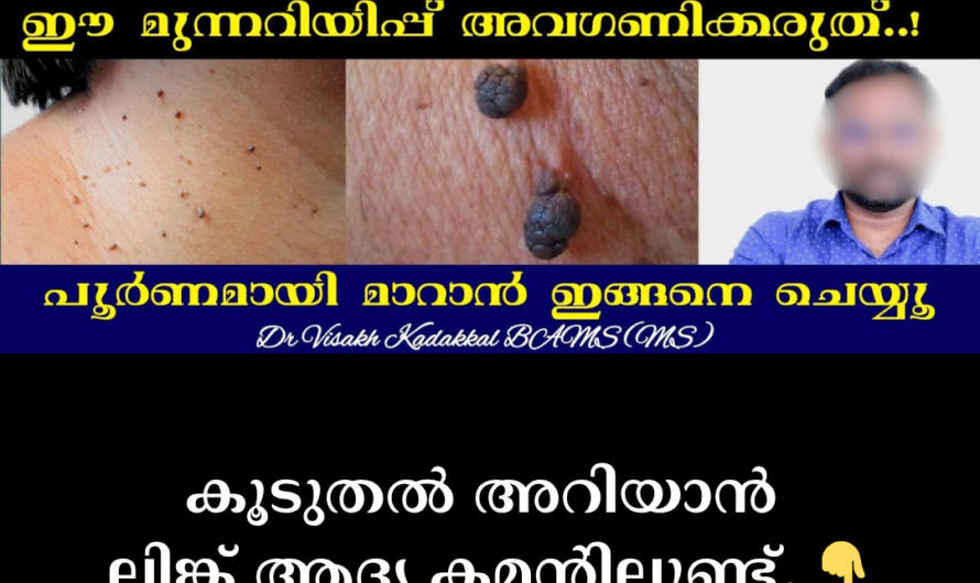 Are those bumps on your skin bothering you? 5 things that can cause skin tags