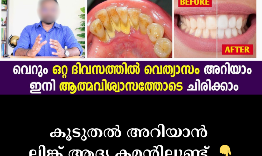 Are you bothered by yellow teeth? Follow these 5 tips to brighten your smile