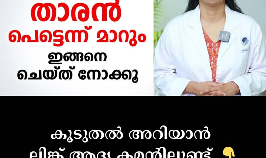 Dandruff won’t go away? Identify these 5 villains that cause itchy scalp and hair loss