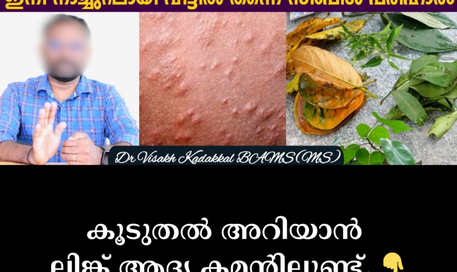 In the same format you requested, the article on the main causes of heat rash/prickly heat in hot weather is given below: