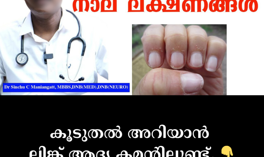 Stroke: Time is precious; 5 main causes of stroke