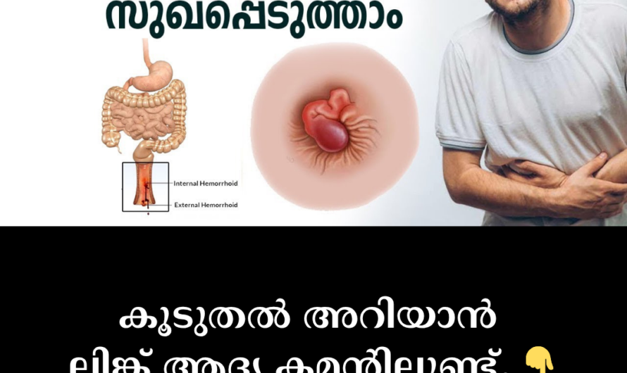 Piles that cause pain and discomfort; 5 main causes