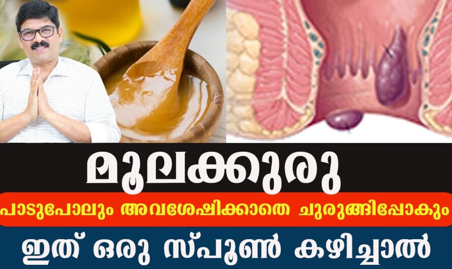 Constipation doesn’t go away? Take care of these to avoid hemorrhoids and fistulas!