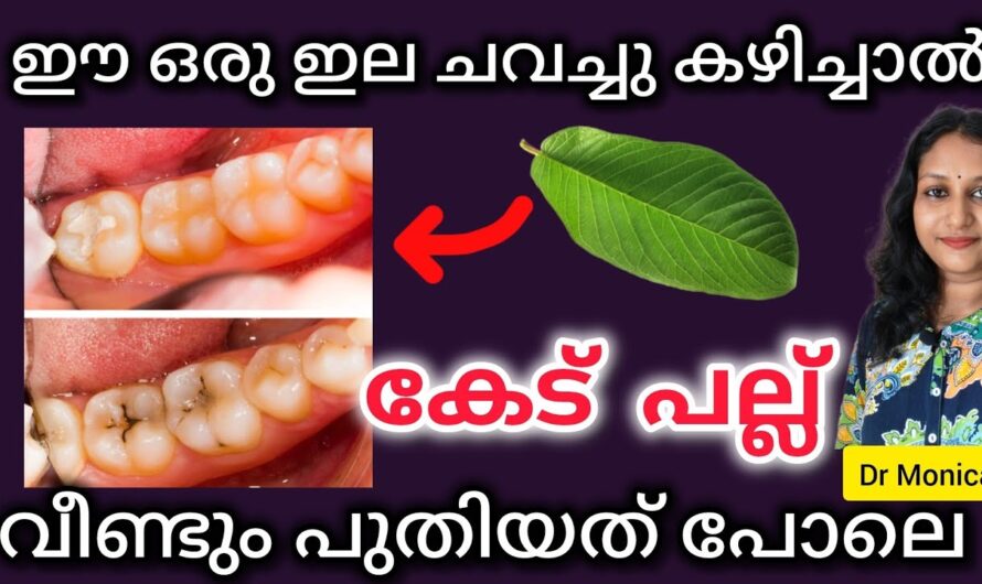 These leaves alone are enough to make your teeth shine like pearls; here are some folk remedies to protect your teeth!