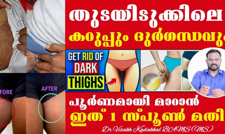 Are you bothered by dark and smelly thighs? Here are the causes and solutions!