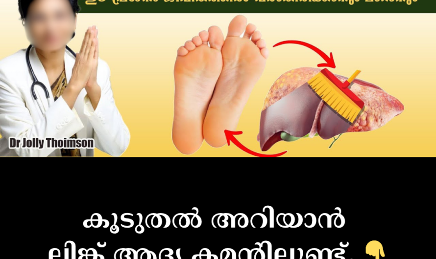 In the same vein as you requested, the article on the condition of fatty liver is given below: