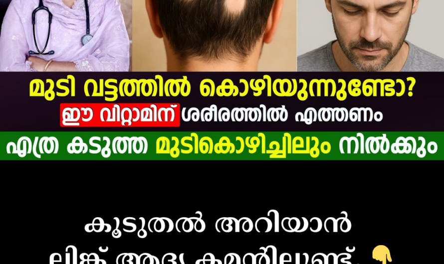 Are you losing hair in patches on your head? 5 things that cause hair loss in circles