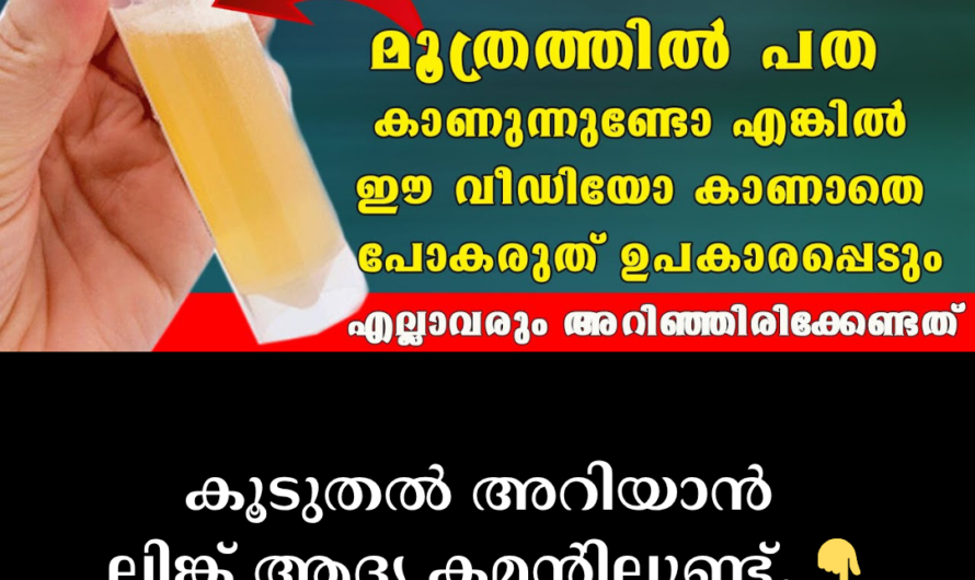 Do you have excessive urine? Don’t ignore it, these could be the reasons!