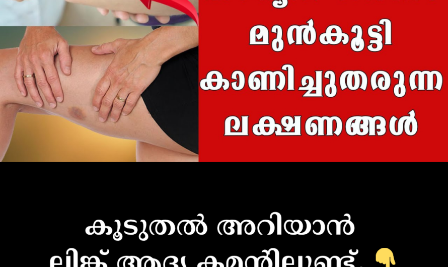 Leukemia: Symptoms can be identified; 5 important causes
