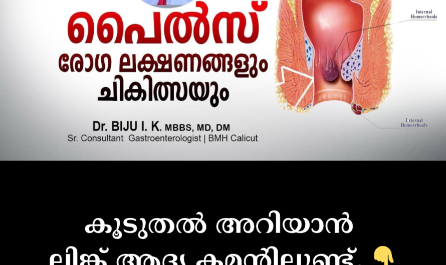 Don’t ignore constipation; 5 main things that cause piles