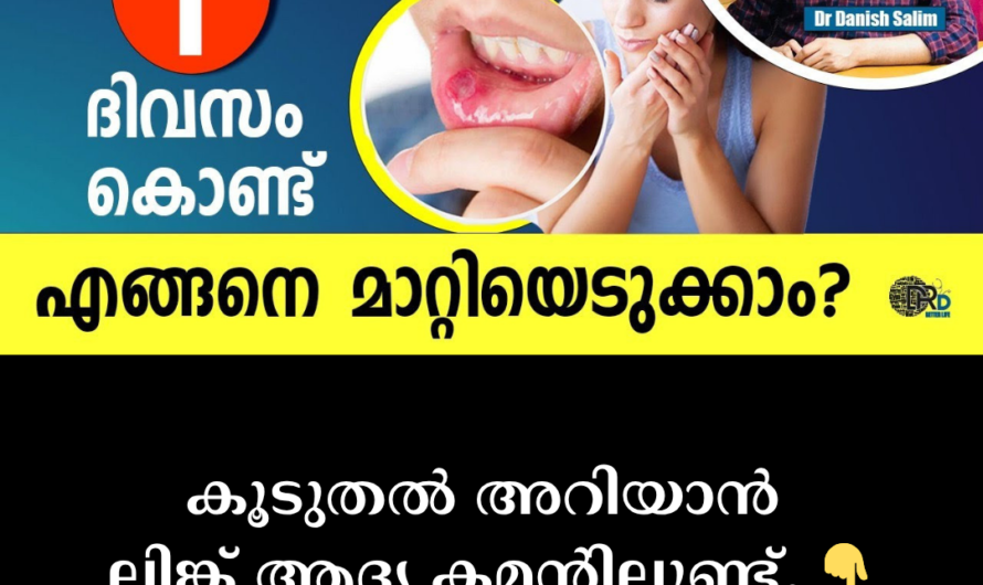 Canker sores that make it difficult to eat; 5 main causes