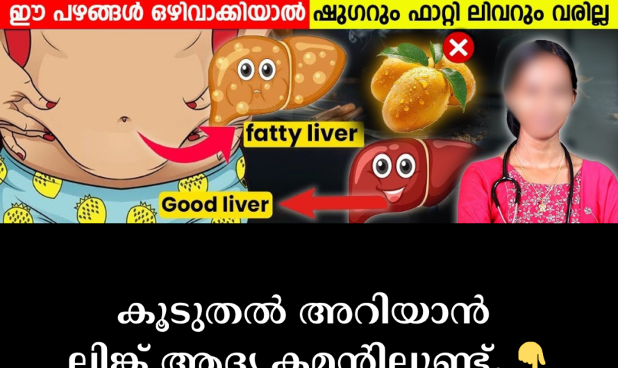 Is fatty liver a trivial matter? 5 main causes of fatty liver