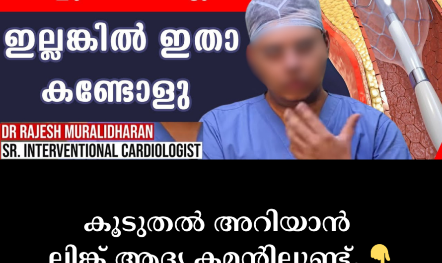 Angioplasty to remove blockages in the heart arteries; When is it needed? Top 5 reasons