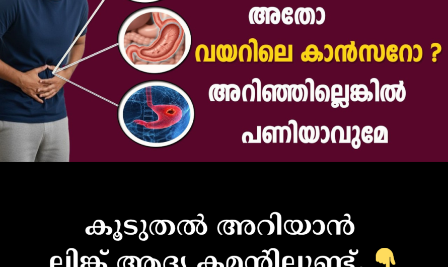Don’t ignore constant heartburn and gas! 5 main reasons behind stomach cancer
