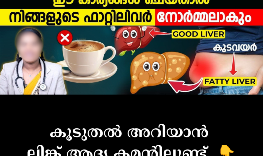 Fatty liver fills the liver without symptoms! 5 main scientific reasons behind fatty liver