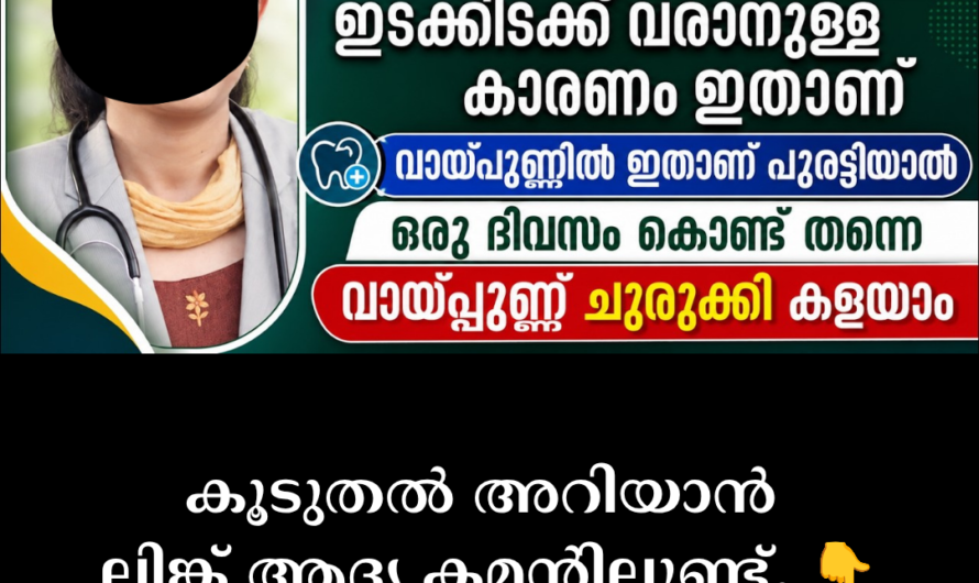 You can’t eat spicy food! 5 main scientific reasons behind mouth ulcers