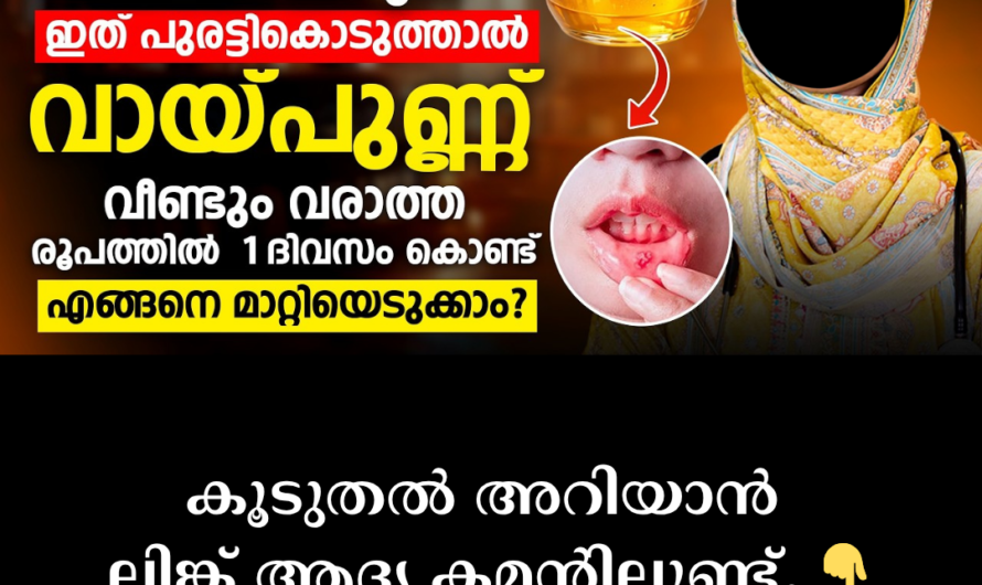 Why do mouth ulcers occur? (Reasons)