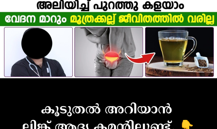 The pain experienced when you have kidney stones is very severe. It is called ‘Renal Colic’ in medical language. Let’s see why this pain is felt so strongly:
