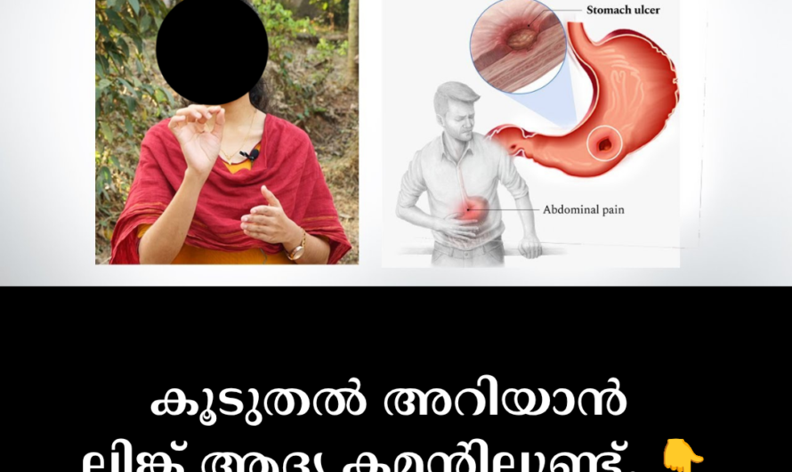 The main reasons for stomach ulcers are as follows: