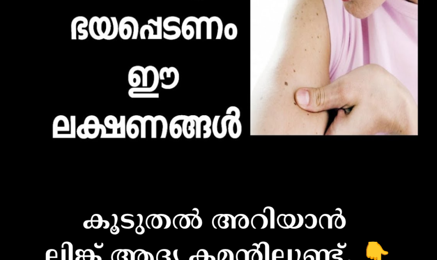 The main factors that cause skin cancer are as follows: